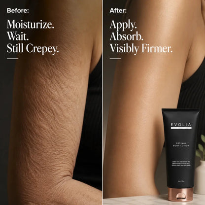 Retinol Body Lotion